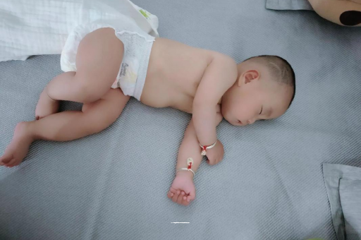 太原宝宝褶皱处擦粉还是油